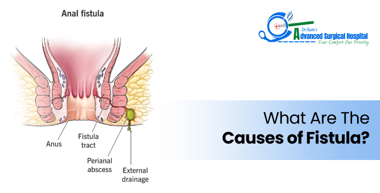 Stages of Fissure Healing