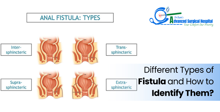 Stages of Fissure Healing